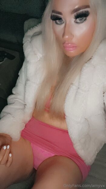 amyvx