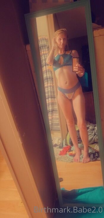 birthmarkbabe2.0
