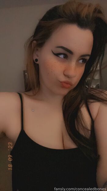 ConcealedBones