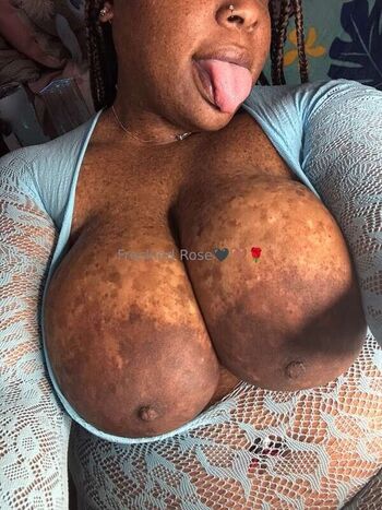 freckledfantasy5