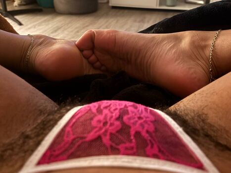 Hairy Women