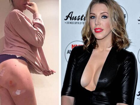 Katherine Ryan