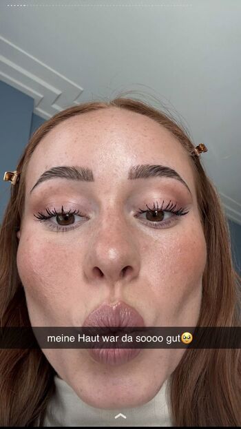 Leoobalys
