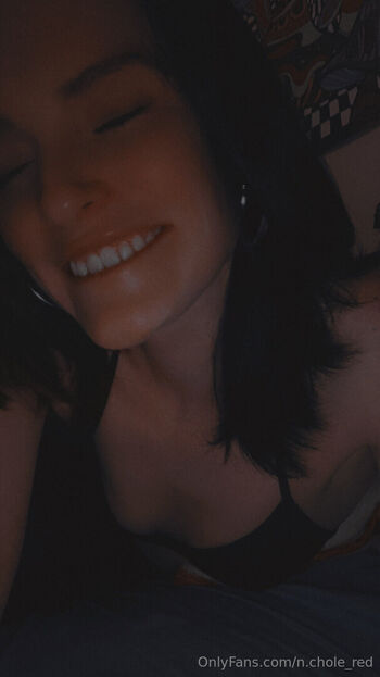 n.chole_red