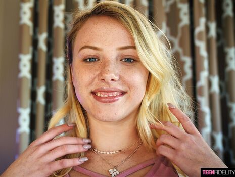 Pale Freckled Girls