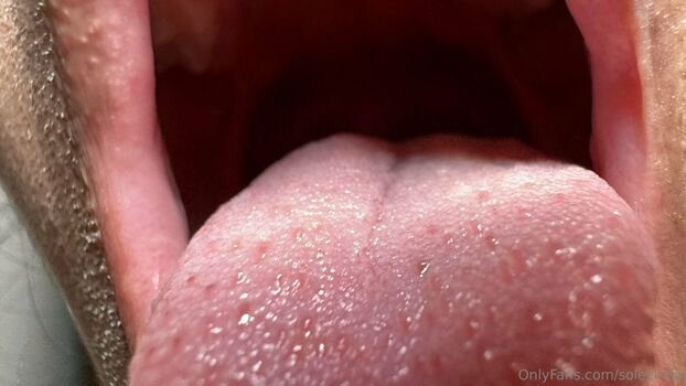 solecirilla
