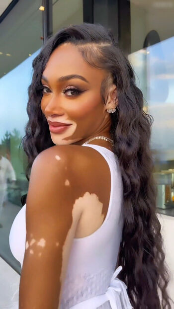 Winnie Harlow