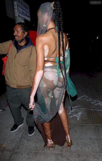 Winnie Harlow