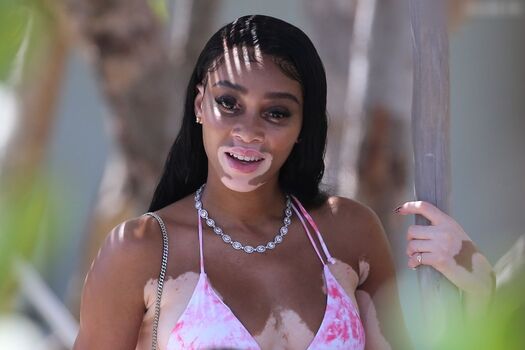 Winnie Harlow