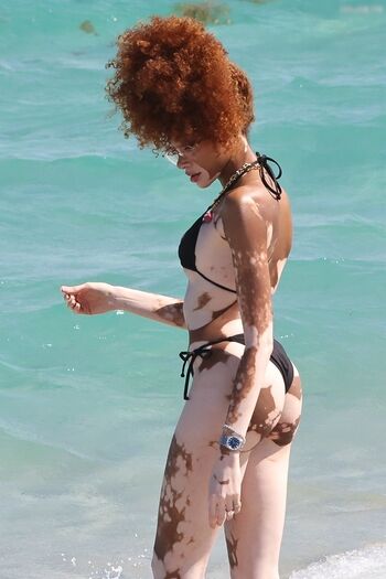 Winnie Harlow