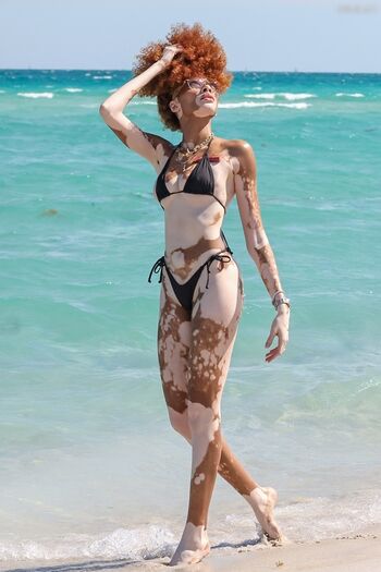 Winnie Harlow