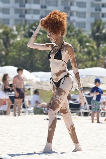 Winnie Harlow