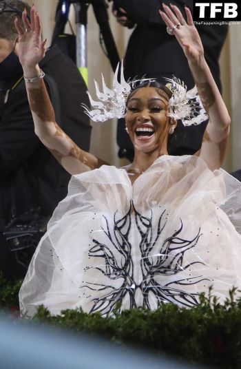 Winnie Harlow